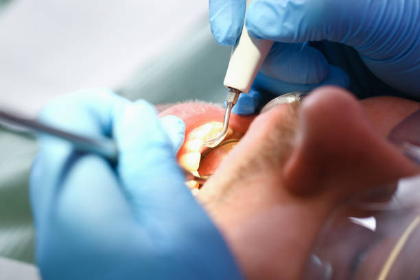 Best Emergency Treatment for Dental Infections or Abscesses in Booneville, AR