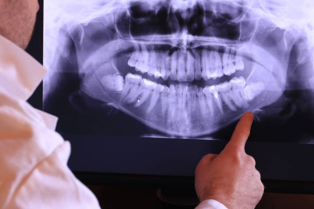 Best Urgent Care for Lost Fillings or Crowns in Booneville, AR